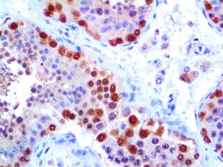 IHC of PGP 9.5 on an FFPE Testicle Tissue